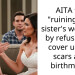 My Sister Said My Scars Will Ruin Her Wedding Photos So I Quit Being Maid Of Honor
