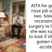AITA for getting a nose job after my two. Sister had reconstructive surgery to look how she was supposed to look if she hadn’t gotten in an accident?