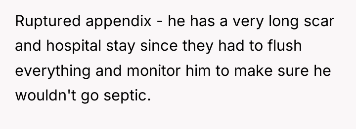Ruptured appendix - he has a very long scar and...
