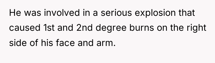 He was involved in a serious explosion that caused 1st...