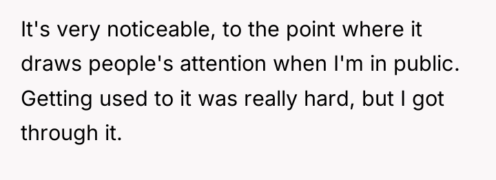 It's very noticeable, to the point where it draws people's...