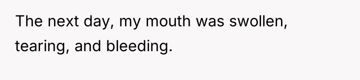 The next day, my mouth was swollen, tearing, and bleeding.
