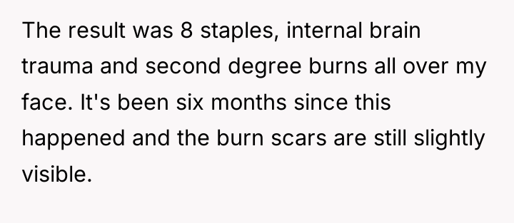 The result was 8 staples, internal brain trauma and second...