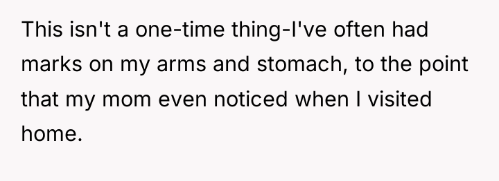 This isn't a one-time thing-I've often had marks on my...
