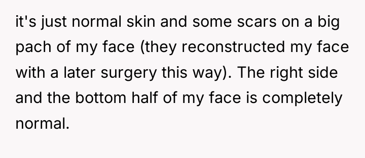 it's just normal skin and some scars on a big...