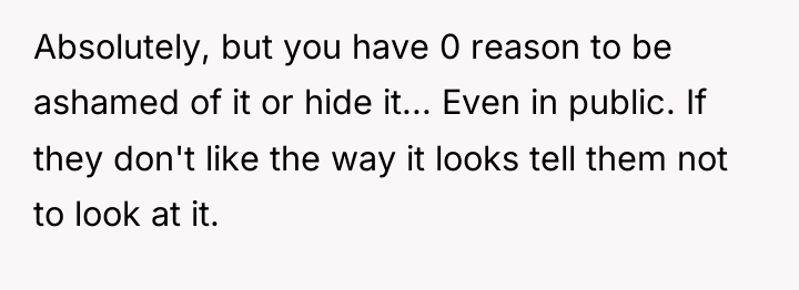 Absolutely, but you have 0 reason to be ashamed of...