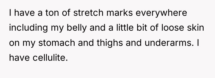 I have a ton of stretch marks everywhere including my...
